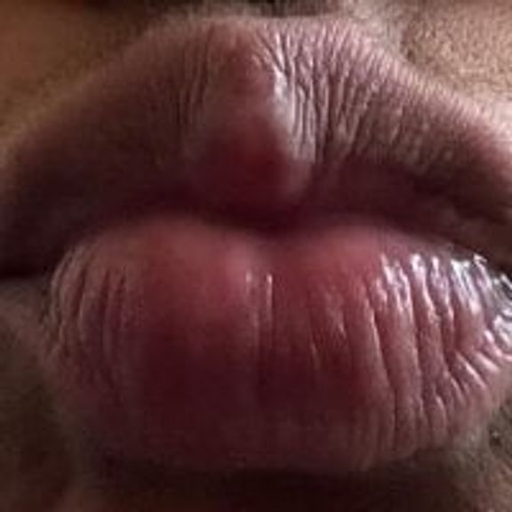 mel_honey