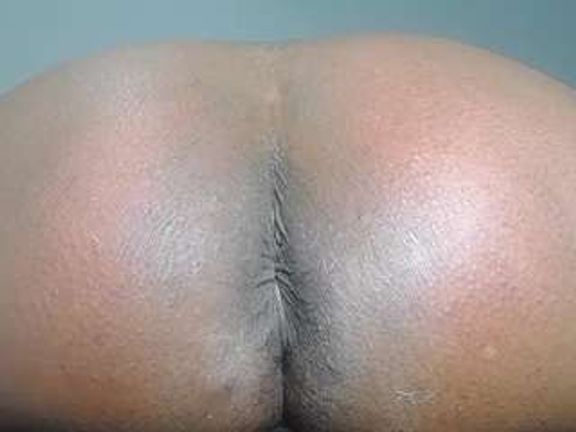 XairaRuiz