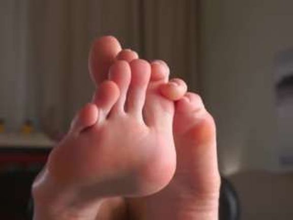 MoireHarbold