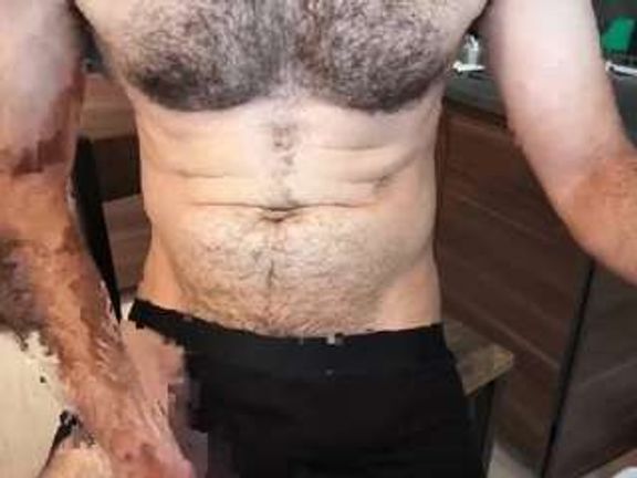 pedroestezIndividual