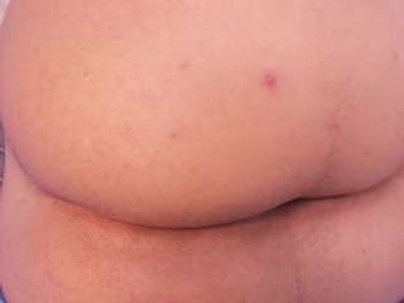alana-rose1