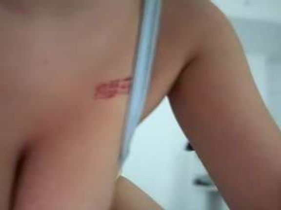 melztube