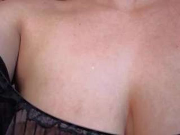 BOOBSKIM