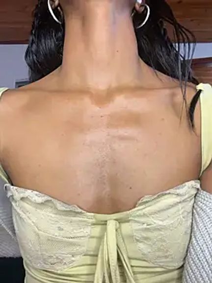 xenia_golden