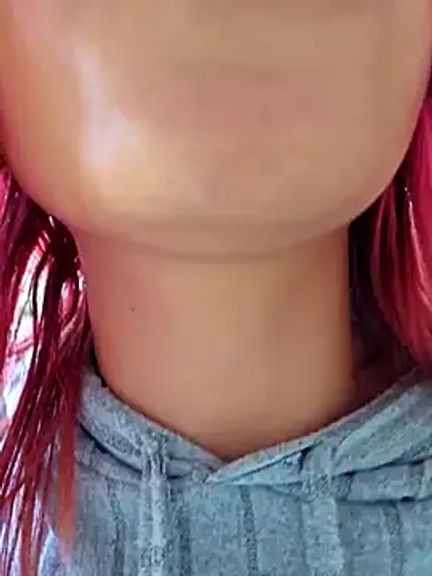 sorpresa_x