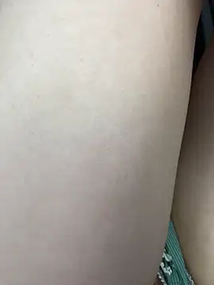 MiraXS