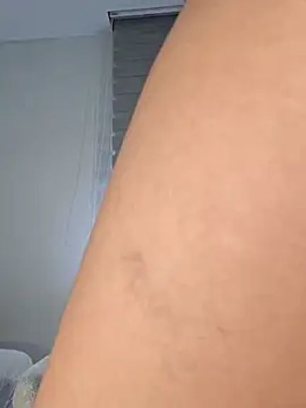 Anal_Luucia