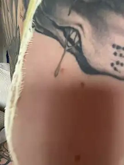 Stella-Kink