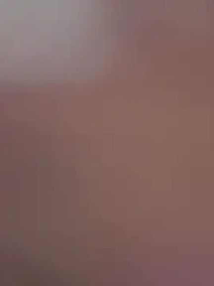 Anal_Top