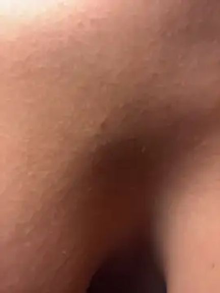 ANABOONCE_